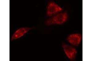 ABIN6275697 staining  A549 cells by IF/ICC.