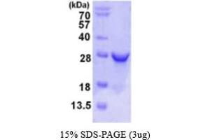 SDS-PAGE (SDS) image for Ribulose-5-Phosphate-3-Epimerase (RPE) (AA 1-228) protein (His tag) (ABIN667693) (RPE Protein (AA 1-228) (His tag))