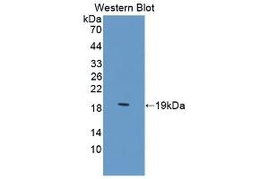 Detection of Recombinant ZBP1, Human using Polyclonal Antibody to Z-DNA Binding Protein 1 (ZBP1) (ZBP1 antibody  (AA 10-167))