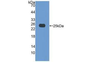 Western blot analysis of recombinant Pig Bax. (BAX antibody  (AA 1-192))