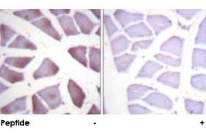 Immunohistochemical analysis of paraffin-embedded human skeletal muscle tissue using PEA15 polyclonal antibody .