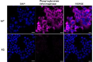 Immunocytochemical staining of HeLa cells using Phosphoglycerate dehydrogenase antibody (ABIN7799808), 1:1,000), Top panel: wild-type (WT), Bottom panal: Phosphoglycerate dehydrogenase shRNA knockdown (KD). (PHGDH antibody)
