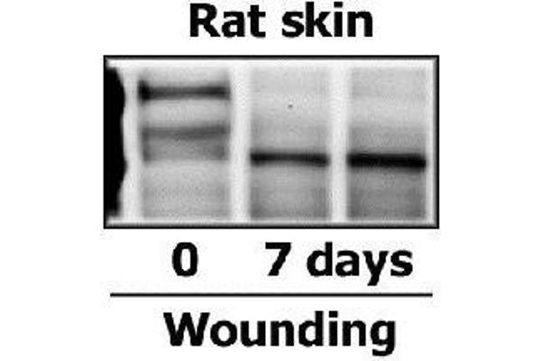 Fibronectin antibody  (AA 1201-1300)