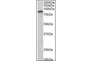 Staining of Human Substantia nigra lysate (35µg protein in RIPA buffer) using SLC6A3 antibody at 1 µg/ml. (SLC6A3 antibody  (Internal Region))