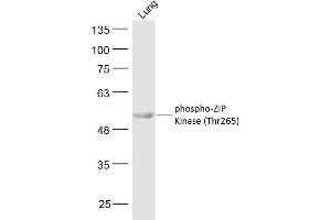 Mouse lung lysates probed with ZIP Kinase (Thr265) Polyclonal Antibody, Unconjugated  at 1:300 dilution and 4˚C overnight incubation. (DAPK3 antibody  (pThr265))