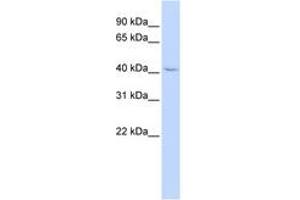 Image no. 1 for anti-Zinc Finger Protein 174 (ZNF174) (AA 216-265) antibody (ABIN6744244) (ZNF174 antibody  (AA 216-265))