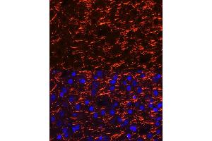 Immunofluorescence analysis of mouse brain cells using PLP1 Rabbit pAb (ABIN7269724) at dilution of 1:100 (40x lens). (PLP1 antibody  (AA 145-210))