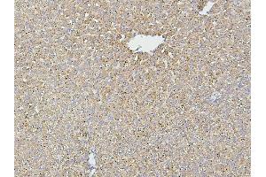 IHC analysis of HSPD1 using anti-HSPD1 antibody (ABIN7600976). (HSPD1 antibody  (AA 260-496))