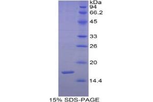 SDS-PAGE analysis of Human Semaphorin 3F Protein.