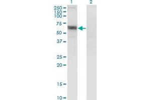 Western Blot analysis of SLC6A16 expression in transfected 293T cell line by SLC6A16 monoclonal antibody (M13), clone 2E5. (SLC6A16 antibody  (AA 406-492))