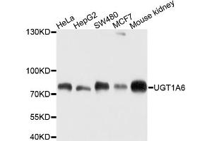 Western blot analysis of extracts of various cell lines, using UGT1A6 antibody (ABIN4905553) at 1:1000 dilution. (UGT1A6 antibody)