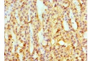 Immunohistochemistry of paraffin-embedded human adrenal gland tissue using ABIN7145594 at dilution of 1:100 (SULT2A1 antibody  (AA 1-145))