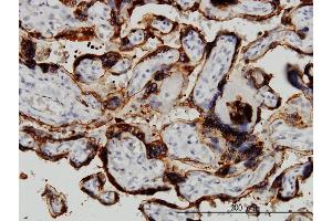 Immunostaining (ISt) image for anti-Hydroxy-delta-5-Steroid Dehydrogenase, 3 beta- and Steroid delta-Isomerase 1 (HSD3B1) (AA 1-373) antibody (ABIN561369)