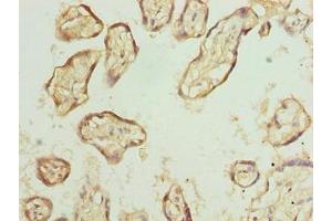 Immunohistochemistry of paraffin-embedded human placenta tissue using ABIN7152281 at dilution of 1:100 (EXOSC1 antibody  (AA 9-195))