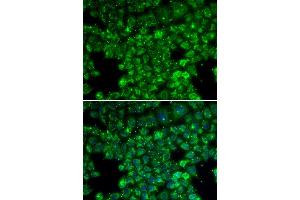 Immunofluorescence analysis of U20S cell using LYZL6 antibody.