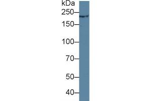 Detection of TCHH in Rat Skin lysate using Polyclonal Antibody to Trichohyalin (TCHH) (Trichohyalin antibody  (AA 1851-1943))