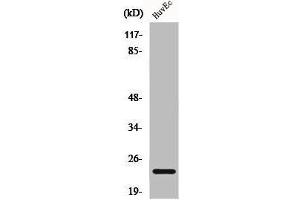 Western Blot analysis of HuvEc cells using Caveolin-1 Polyclonal Antibody (Caveolin-1 antibody  (C-Term))