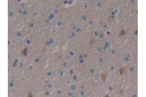 Detection of ENO3 in Human Brain Tissue using Polyclonal Antibody to Enolase 3 (ENO3) (ENO3 antibody  (AA 1-391))