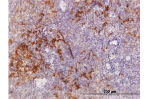 Immunoperoxidase of purified MaxPab antibody to TRAF1 on formalin-fixed paraffin-embedded human tonsil. (TRAF1 antibody  (AA 1-416))