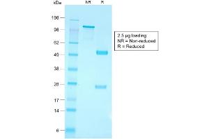 SDS-PAGE Analysis of Purified CD79a Rabbit Recombinant Monoclonal Antibody ABIN6383859. (Recombinant CD79a antibody  (AA 202-216))