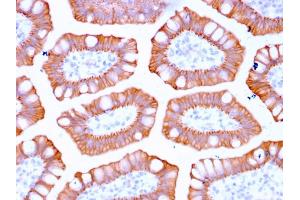 Immunohistochemistry (IHC) image for anti-Keratin 20 (KRT20) (AA 196-323) antibody (ABIN6940352)