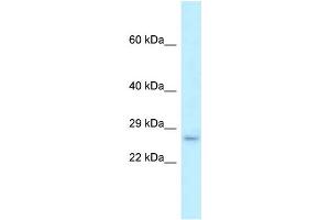 WB Suggested Anti-Fam176b Antibody Titration: 1. (EVA1B antibody  (Middle Region))