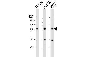 All lanes : Anti-NAGS Antibody (Center) at 1:1000 dilution Lane 1: human liver lysate Lane 2: HepG2 whole cell lysate Lane 3: K562 whole cell lysate Lysates/proteins at 20 μg per lane. (NAGS antibody  (AA 275-309))
