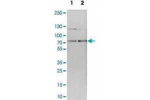 Western blot analysis of cell lysates with RNGTT polyclonal antibody .