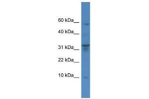 Western Blot showing CTSC antibody used at a concentration of 1-2 ug/ml to detect its target protein. (CTSC antibody  (Middle Region))