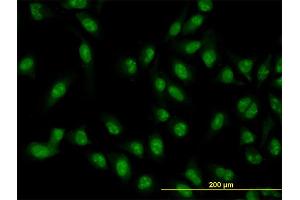 Immunofluorescence of monoclonal antibody to XAB2 on HeLa cell. (XAB2 antibody  (AA 1-855))