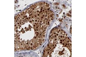 Immunohistochemical staining of human testis with HUWE1 polyclonal antibody  shows strong nuclear and cytoplasmic positivity in cells of seminiferus ducts.