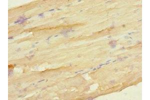 Immunohistochemistry of paraffin-embedded human skeletal muscle tissue using ABIN7153183 at dilution of 1:100 (FZD3 antibody  (AA 23-205))