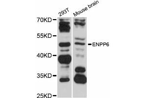 Western blot analysis of extracts of various cell lines, using ENPP6 antibody (ABIN5997678) at 1/1000 dilution. (ENPP6 antibody)