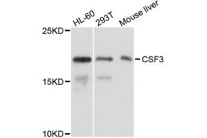 Western blot analysis of extracts of various cell lines, using CSF3 antibody (ABIN5973635) at 1/1000 dilution. (G-CSF antibody)