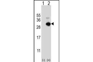 Western blot analysis of GSTO1 (arrow) using rabbit polyclonal GSTO1 Antibody (Center) (ABIN389475 and ABIN2839537). (GSTO1 antibody  (AA 126-155))