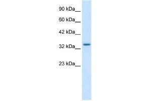 WB Suggested Anti-ZNF134 Antibody Titration:  1.