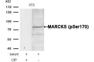 Western blot analysis of extracts from 3T3 cells, treated with serum or calf intestinal phosphatase (CIP), using MARCKS (phospho-Ser170) Antibody. (MARCKS antibody  (pSer170))