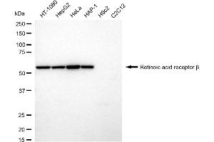 Western blotting analysis using Retinoic acid receptor beta antibody (ABIN7800190).