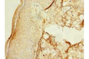 Immunohistochemistry of paraffin-embedded human skin tissue using ABIN7174599 at dilution of 1:100 (UBXN6 antibody  (AA 1-388))