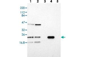 Western blot analysis of Lane 1: RT-4, Lane 2: U-251 MG, Lane 3: Human Plasma, Lane 4: Liver, Lane 5: Tonsil with LDOC1L polyclonal antibody  at 1:250-1:500 dilution.