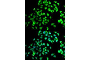 Immunofluorescence analysis of MCF7 cell using NCBP2 antibody.