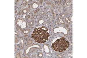 Immunohistochemical staining of human kidney with TJP1 polyclonal antibody  shows distinct membranous and cytoplasmic positivity in cells of glomeruli. (TJP1 antibody)