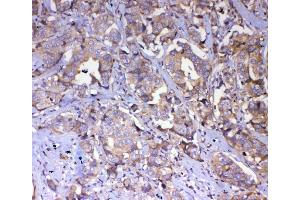 IHC analysis of IQGAP2 using antiIQGAP2 antibody (ABIN5692877). (IQGAP2 antibody  (AA 1329-1544))