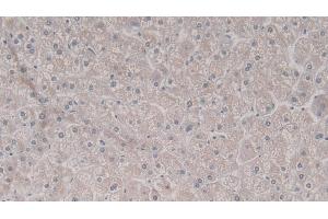 Detection of TRADD in Human Liver Tissue using Polyclonal Antibody to TNFRSF1A Associated Via Death Domain Protein (TRADD) (TRADD antibody  (AA 61-297))
