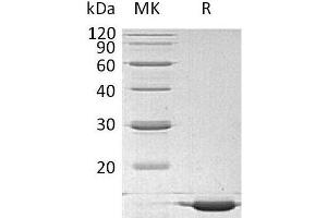 Western Blotting (WB) image for Interleukin 1 alpha (IL1A) protein (ABIN7320583) (IL1A Protein)