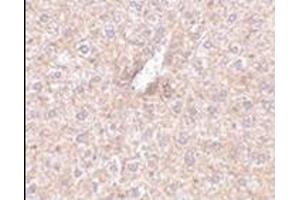 Immunohistochemistry of STEAP3 in mouse liver tissue with this product at 2.