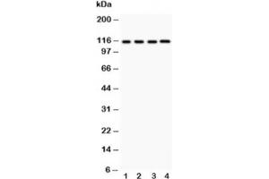 Western blot testing of NALP3 antibody and Lane 1:  HeLa (NLRP3 antibody  (AA 21-194))