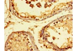 Immunohistochemistry of paraffin-embedded human testis tissue using ABIN7157230 at dilution of 1:100 (KANSL1 antibody  (AA 815-1086))