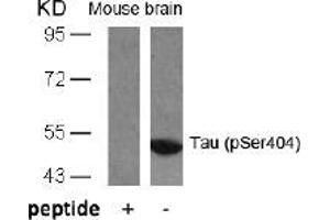 Image no. 1 for anti-Microtubule-Associated Protein tau (MAPT) (pSer404) antibody (ABIN196810) (MAPT antibody  (pSer404))