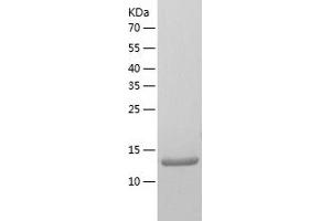 Western Blotting (WB) image for KH Homology Domain Containing 1-Like (KHDC1L) (AA 1-128) protein (His tag) (ABIN7287495) (KHDC1L Protein (AA 1-128) (His tag))